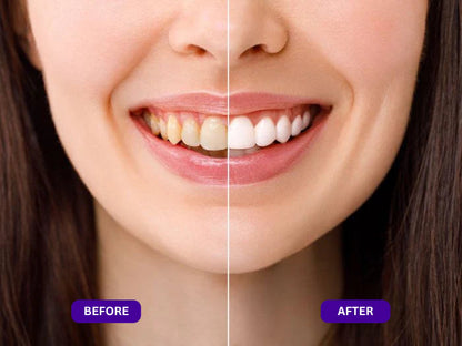 Vopani™ Purple Mouth Wash