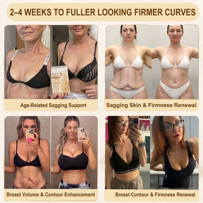 Slimifyvibe®🏆 Bust Volume, Lift & Firming Nano Microneedle Patch Volufiline + Exosome + Copper Peptide Formula Powered by Cellular Renewal Technology