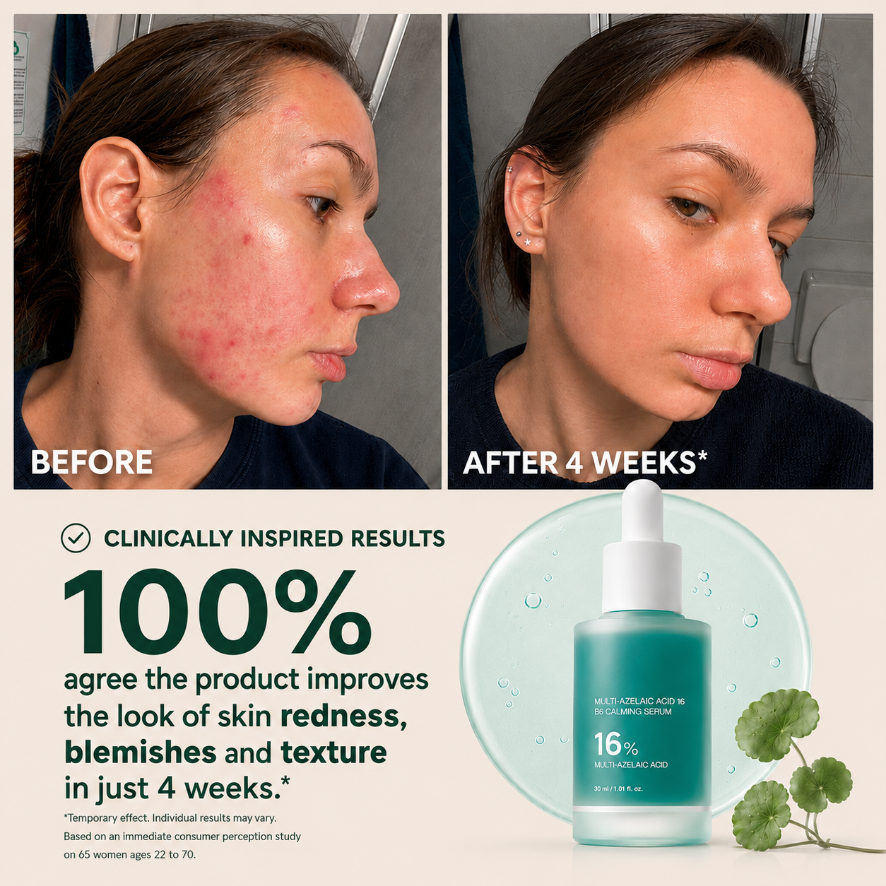 Blessedkui Anchoic Acid Soothing Serum-gm