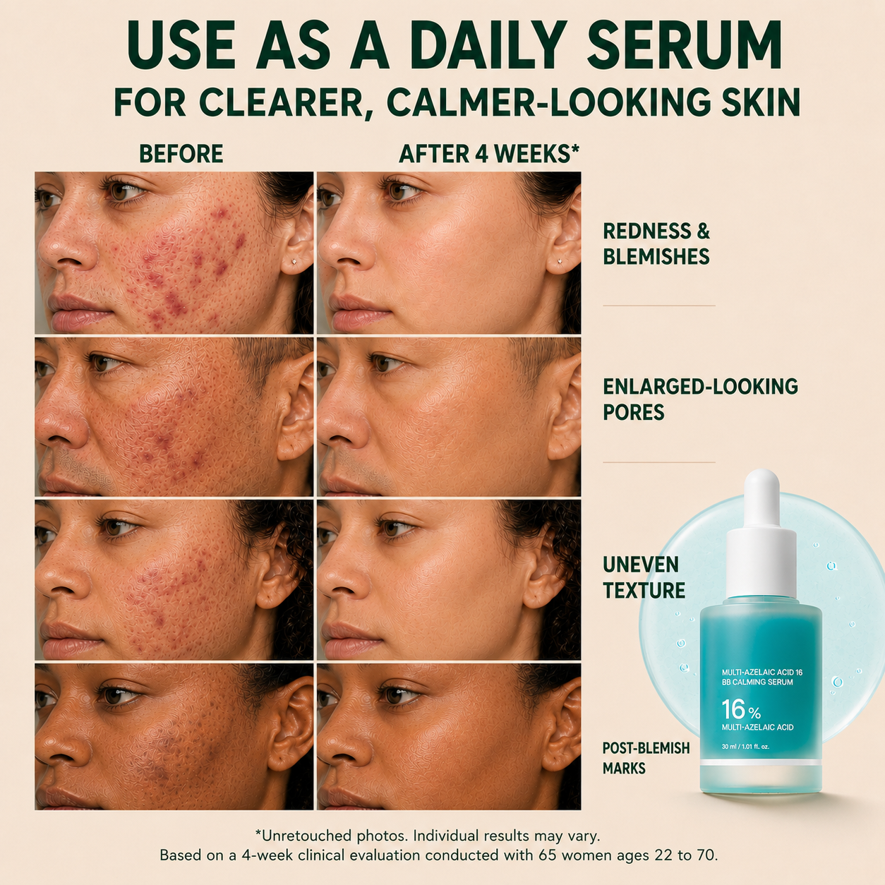 Blessedkui Anchoic Acid Soothing Serum-gm