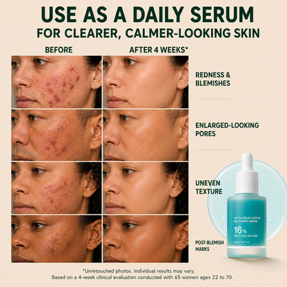 Blessedkui Anchoic Acid Soothing Serum-gm