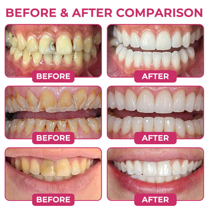 COUGEX®  Cavity-Repair Natural Enamel Filling Gel-gm