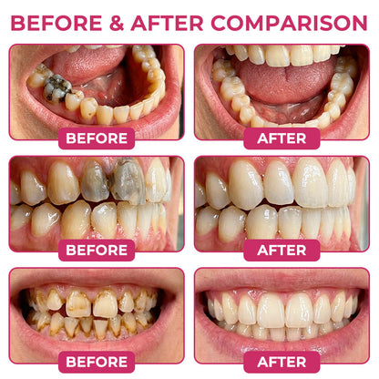 COUGEX®  Cavity-Repair Natural Enamel Filling Gel-gm