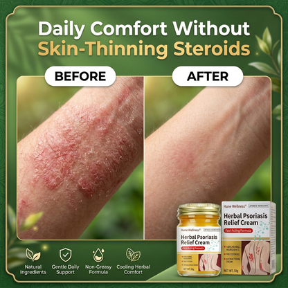 Herbal Psoriasis & Eczema Relief Skin Cream-gm