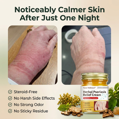 Herbal Psoriasis & Eczema Relief Skin Cream-gm