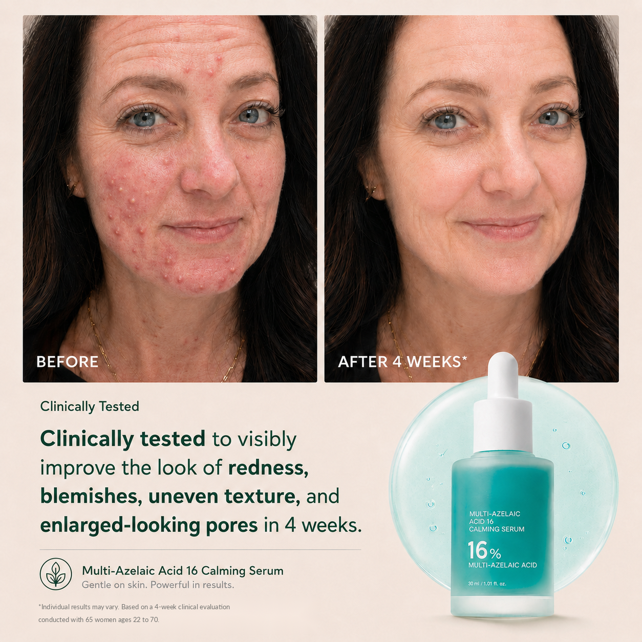 Blessedkui Anchoic Acid Soothing Serum-gm