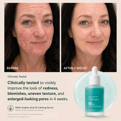 Blessedkui Anchoic Acid Soothing Serum-gm